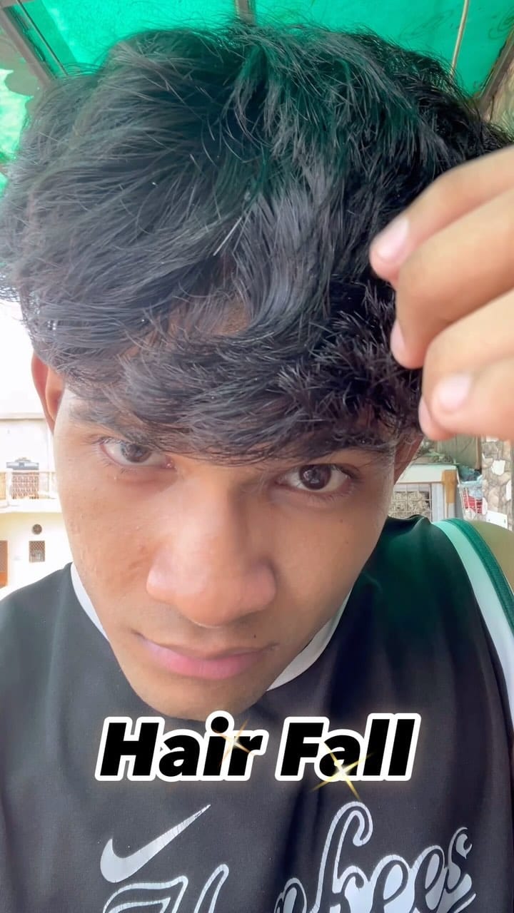 #hairfall