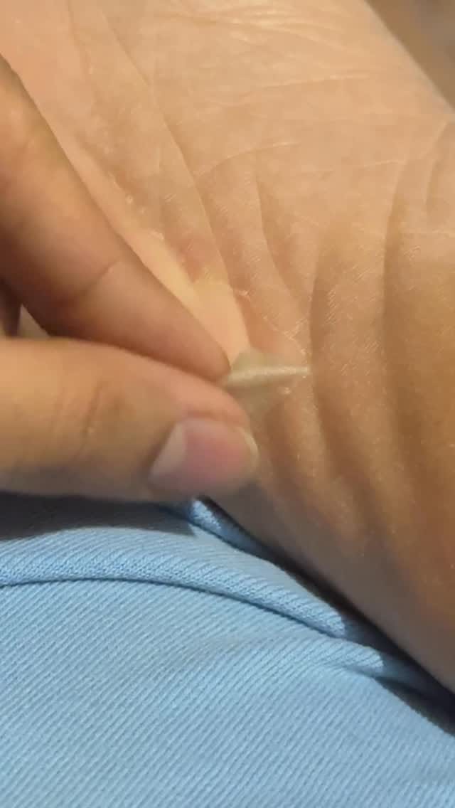 ‼️Read caption for details‼️
Be honest… when was the last time you gave your feet actual attention? 👀
Because same until I tried this crazy satisfying foot mask and watched my dead skin literally peel off on its own 😭💫
You just slip it on, chill for 90 mins 🕒, rinse it off, and then wait a few days for the magic to happen your old skin starts shedding naturally (so satisfying to watch ngl 👀).
The secret? 🍋 Fruit AHAs & BHAs gently break down rough, dead skin while botanical extracts like aloe, green tea & lavender soothe, hydrate, and leave your feet feeling silky soft 🌿✨
Basically… it’s like a mini pedicure spa you can do from your couch 💅
So if your heels are looking a little “dry-season chic” right now 😭 this is your sign 
(foot exfoliating mask, foot peel mask, baby soft feet, remove dead skin, foot care routine, at home pedicure, smooth heels, foot mask review, skincare for feet, AHA BHA exfoliation, Selfcare, pampered) 
#foryou #explore #beautybloggers #viralproducts #beautytips #footexfoliation #skinpeel #exfoliation #deadskin #pedicureathome #selfcareeveryday