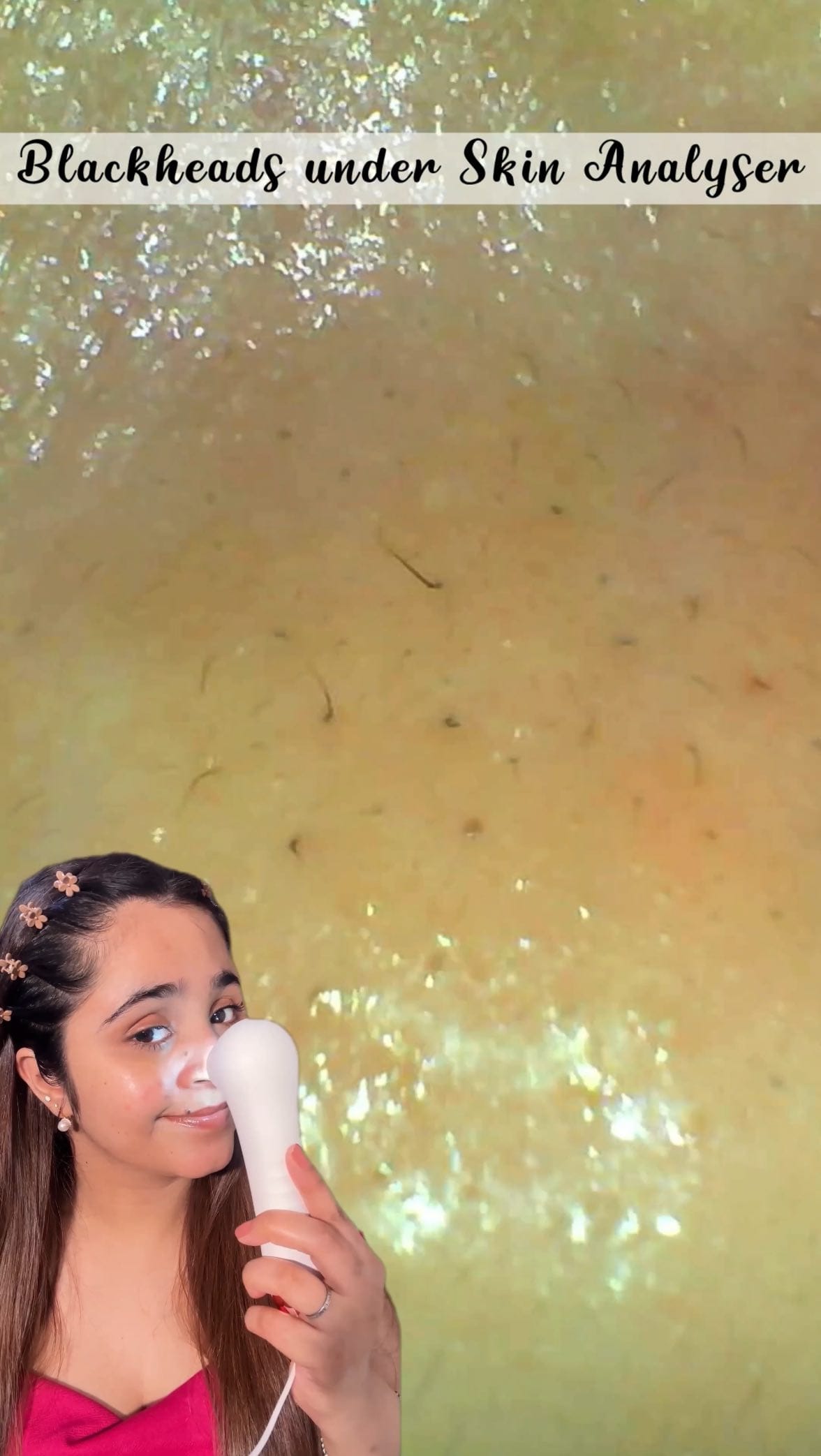 #notsponsored - Comment “Nose” for direct link🎀✨
This 3-in-1 nose mask from Miniso is just Rs.60 (Rs.20 per mask!)
Step 1 - The bubble mask goes to work, opening up your pores and softening those blackheads. The mask goes from slimy to cloudy!
Step 2 - The charcoal strip helps in pulling out all
the dirt and impurities that have been hiding in your pores. It’s like a deep clean for your nose! You can actually see the gunk stripping out and it’s so satisfying.
Step 3 - The soothing strip steps in to calm and tighten your pores, leaving your nose feeling refreshed and renewed. It’s like a cool breeze for your nose!
Brand - @tonymoly.in_official @tonymoly @minisoindia @miniso.official 
#nosestrips #nosestrip #blackhead #whiteheads #nosecare #koreanskincare #koreanskincareroutine #bubblesheetmask #sheetmask #facemask #miniso #koreanskincareproducts #affordableskincare #affordableskincareproducts #affordableskincarethatworks #affordableskincareroutine #amazonfinds #amazonskincare #glassskinroutine #winterskincare #cleangirl #pores #nosemask #iggrowth #igreach 
Tags - skincare that works, affordable skincare that works, drugstore makeup, testing vitamin C serum, vitamin C serum for skincare, vitamin c for
pigmentation, skin pigmentation, acne scars treatment, treating skin pigmentation, affordable makeup finds, trending audio, viral products korean skincare products that work hormonal acne spots, black head removing mask nose strips unique products testing viral products