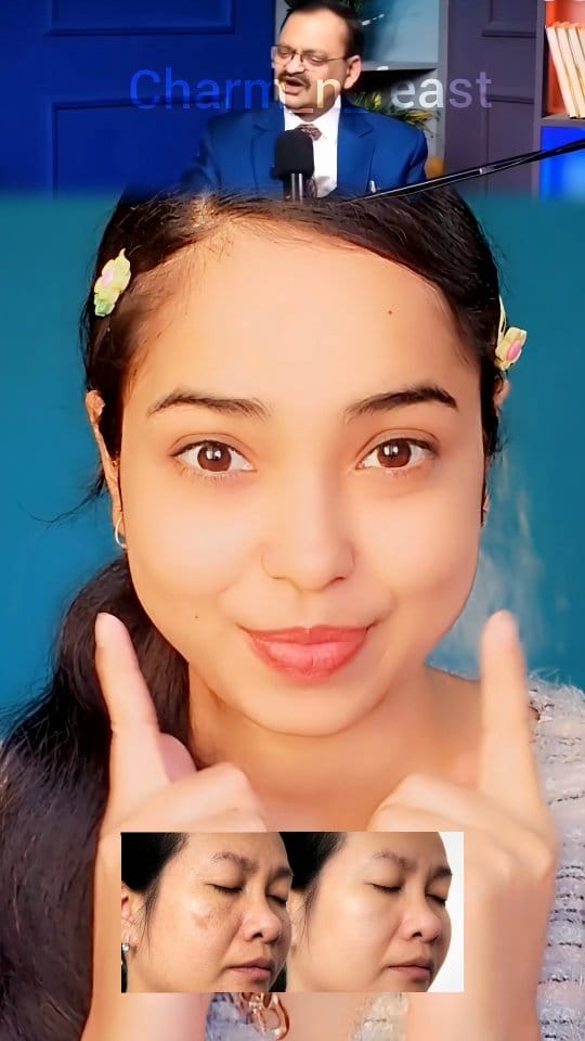 Comment for "Link "
#pigmentation #hyperpigmentation #melasma #skinbrightening #skincare 
[ pigmentation, darkspots, melasma, skin]