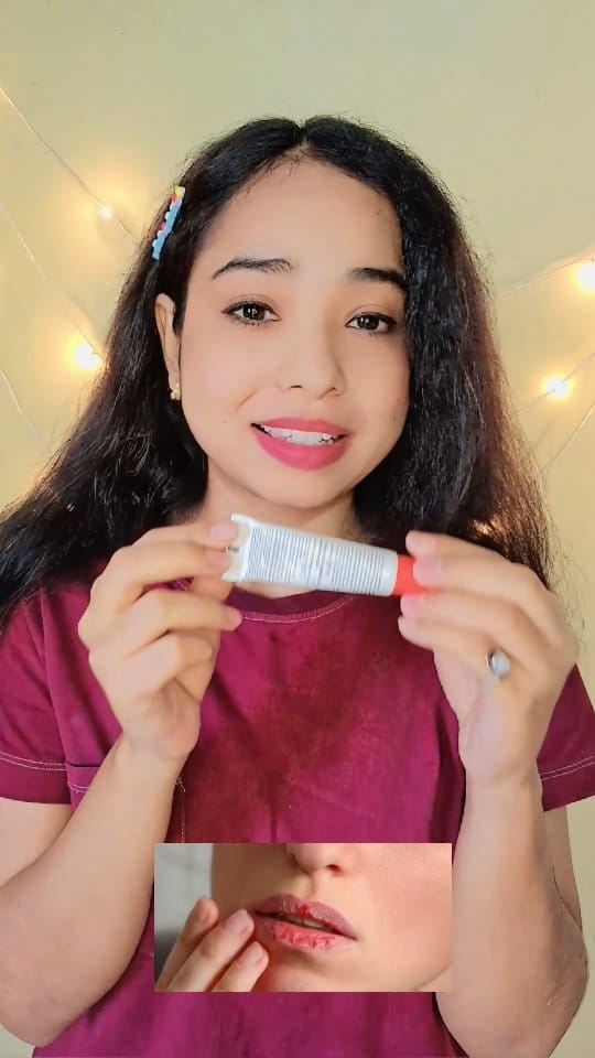 Comment for Link 
#lipcare #chappedlips #drylips #drylips #cracklips #winterskincare #beautytips #lipgloss #beautytips 
#giveaway #viralvideos #lipspigmentation #skincare 
[ lipstick, lipgloss, cracklip, skincare, beautytips]