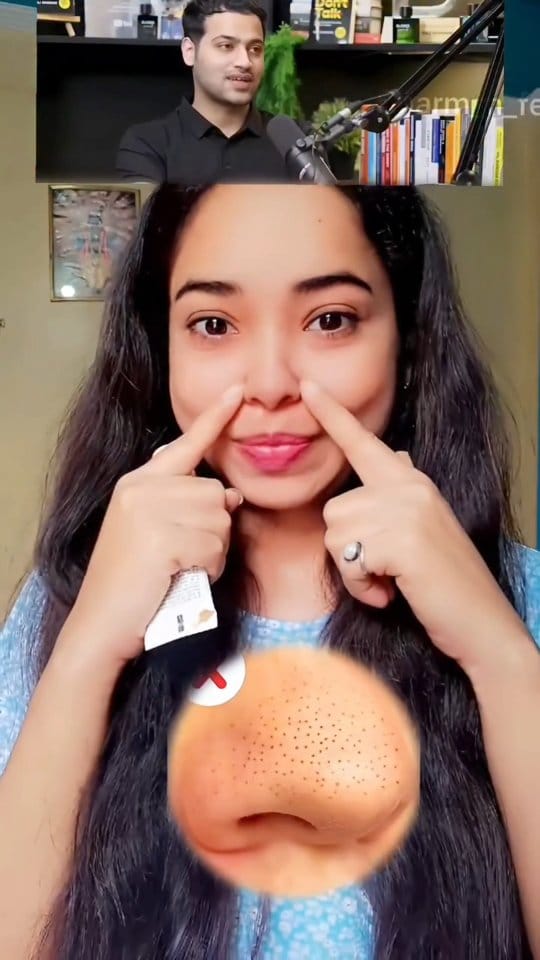 Blackheads removal 
 ⚠️_ Lgne se phle patch test jarur kar le sb ka skin type alg alg hota h jise apko koi prblm nhi ho 
#Blackheads #blackheadsremover #blackheadsremoval #whiteheads #naturalremedies #beautytips #acne #Pimple #acnetreatment 
[ blackheads, whiteheads, acne, Open pores]