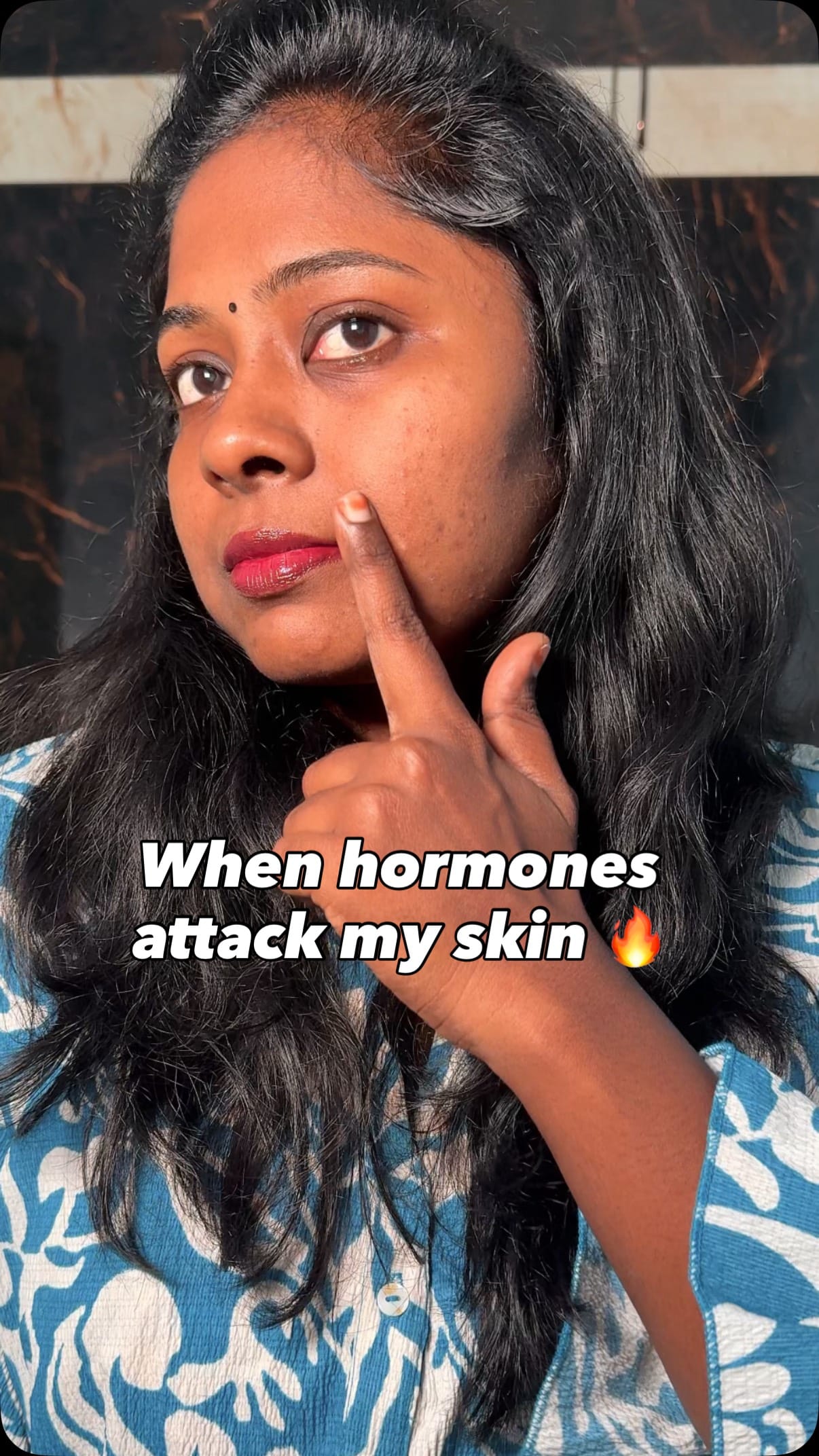 When your period hits… and your skin barrier decides to quit 😩💔
This is what helped me calm it down — no filters, no panic 💚
Comment “FIX” for the link 🫶
#periodacne #barrierrepair #glowingskin 
period acne care, hormonal acne routine, skin barrier repair, acne during periods, how to calm sensitive skin, barrier repair skincare, period skin routine, skin barrier healing, how to fix damaged barrier, best ceramide serum, green tea skincare, innisfree green tea ceramide serum in milk, serum for sensitive skin, barrier strengthening serum, lightweight hydrating serum, soothing skincare for acne, acne safe hydration, dry and irritated skin fix, skincare for barrier damage, post acne skin recovery, best product for skin barrier, glass skin hydration, period acne solution, how to calm redness, repair skin barrier fast, acne safe moisturizer, ceramide hydration serum, milky texture skincare, skin barrier reset, sensitive skin savior, innisfree serum for acne, innisfree barrier serum, korean skincare for acne, barrier safe skincare, deep hydration skincare, calm and glowing skin, barrier care routine, hydration glow skincare, period acne treatment naturally, glowing skin barrier care
#innisfreeindia #innisfree #greenteaceramidemilk #skincarejourney #barrierhealth #hormonalacne #acnecare #senstiveskin #barrierrepair #acnehealing #skinreset #skincareroutine #hydratedskin #innisfreegreentea #skincaretips #skincarecreator #skincareinstagram #glowyskincare #glassskin #acnefriendly #periodstruggles #periodstories #chennaiinfluencer #beautycommunity 
Does your skin also freak out during periods? 😩