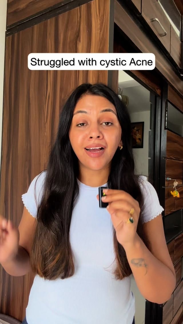 The Serum That Cleared My Marks ✨
Benefits of Pilgrim 10% Niacinamide Serum:
✅ Reduces acne marks
✅ Reduces oiliness
✅ Increases ceramide on the skin
✅ Reduces sebum production
10% Niacinamide Serum @discover.pilgrim 
#postpartumskin #newmomlife #PilgrimSkincare #Niacinamide #NiacinamideSerum #ClearSkinJourney #AcneMarks #shikhavlogs