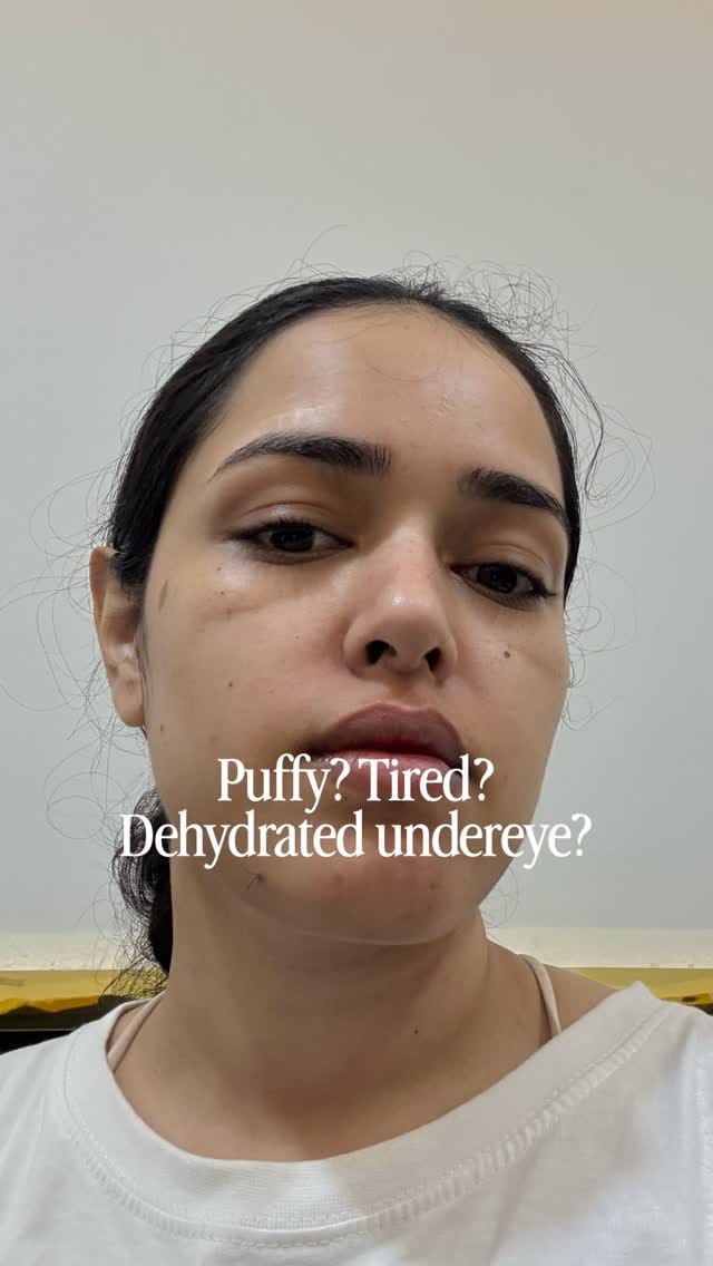 Comment ‘eye’ for direct links 🔗
Honestly, I’ve been recommending this since 2024 and I still stand by it! 🫶
The Axis-Y Eye Serum with its cool-touch applicator is so relaxing, soothing, and calming. It really helps with puffiness and tired eyes 👀💙.
I take it with me everywhere, use it before makeup, and in the mornings, it’s such a must-have in my routine. 
#axisy #eyeserum 
#tiredeyes 
{puffiness, eyes, skincare, eye care, fresh eyes, tired eyes}