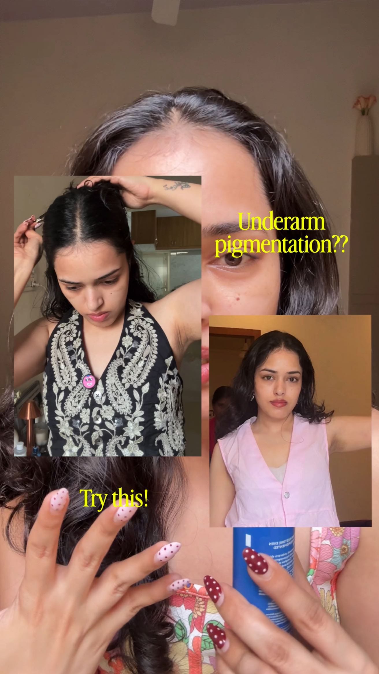 Comment ‘pigmentation’ for links 🔗 So here’s the thing, I’ve always had a bit of underarm pigmentation (which is super normal btw, nothing to stress about). But I randomly started testing this underarm spray, just out of curiosity and the results??
In 2 weeks, I could see a difference. The pigmentation has visibly reduced and my skin actually feels smoother. I use it once a day, just a few spritzes, and it’s honestly been doing magic.
The formula has glycolic acid, lactic acid and Asaya’s own formula MelaMe complex, sounds intense but it’s actually super gentle, doesn’t sting or irritate your skin at all. 🫶
If you haven’t tried it yet, seriously, you’re missing out, this one’s a hidden gem!
#underarmpigmentation #darkunderarms #beautytips