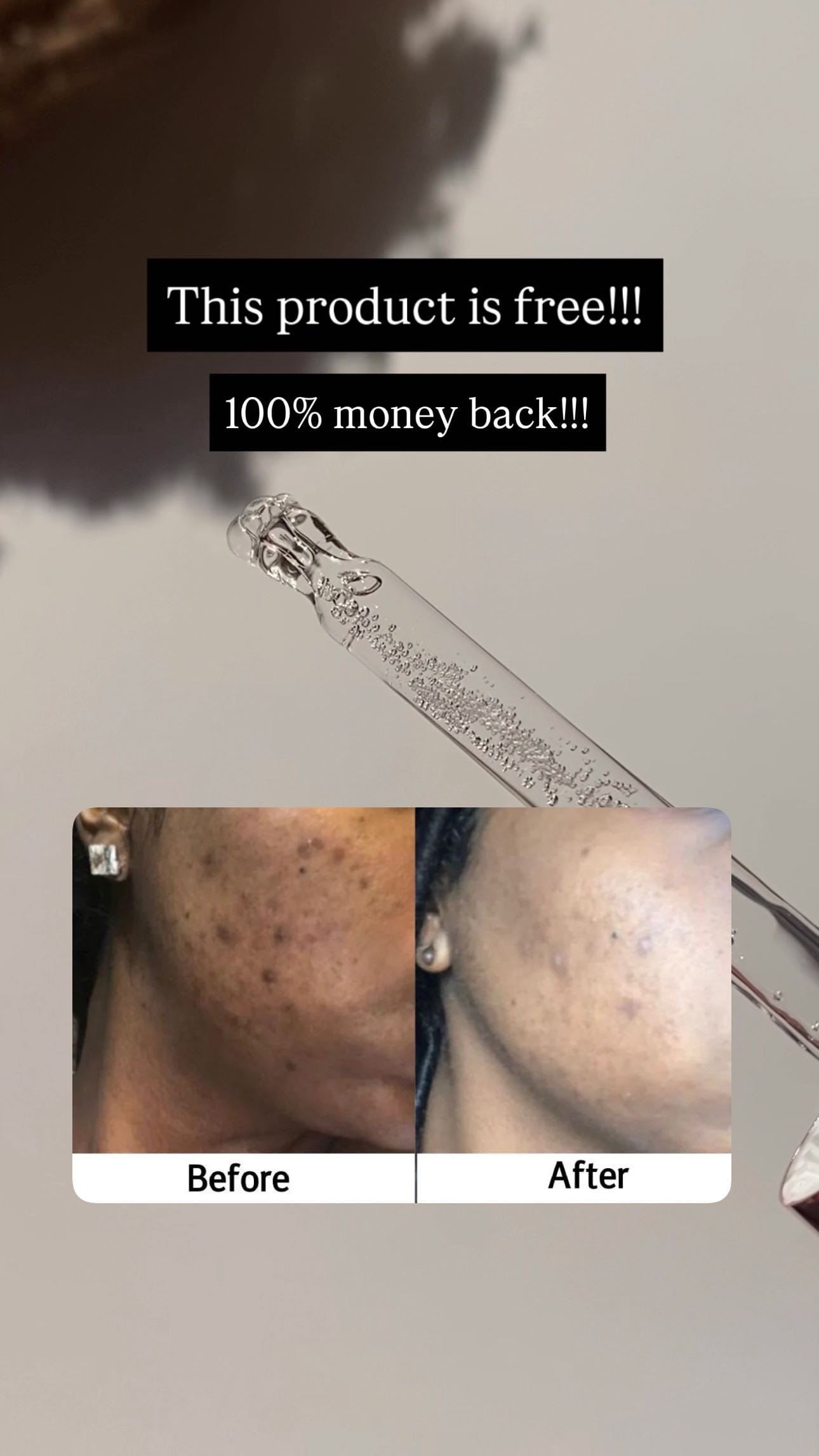 Personally tried & 100% recommended
Ad
Follow @kaluvaa_ for more ❤️
#ad #pigmentation #darkspots #skincare #vizagblogger #andhrapradesh