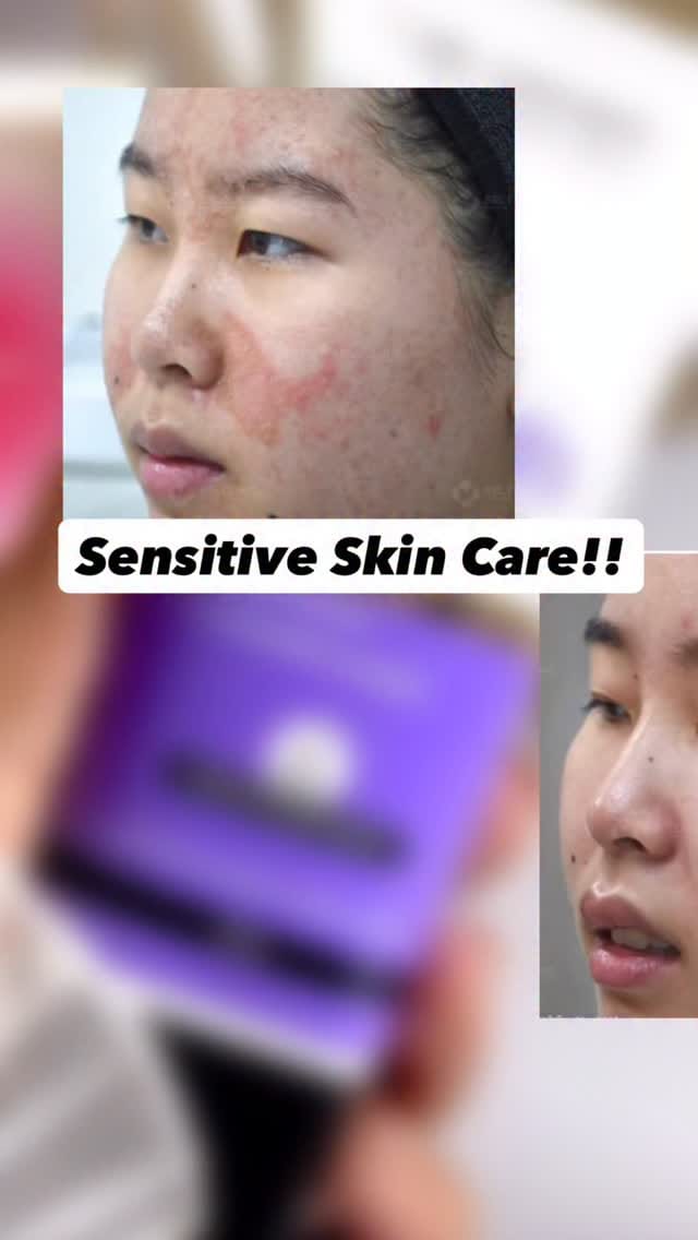 Sensitive skin? Meet your calm duo.
Start with Dr. Sheth’s Oats & Ceramide Sunscreen to protect without irritation, then layer the Oats & Ceramide Moisturizer to soothe and strengthen your barrier.
No redness. No sting. Just calm, hydrated, happy skin all day. 💛
.
.
@drsheths 
[Sensitive skin care, skincare, sunscreen for sensitive skin, moisturizer for sensitive skin, redness , irritation, calm skin, oats and ceramides, barrier repair , for you page, fyp , Explore page, Explore more]
.
.
#sensitiveskincare #oats #ceramides #redness #barrierrepair #fyp #foryoupage #explore #explorepage✨ #sunscreen #moisturiser #calmskin