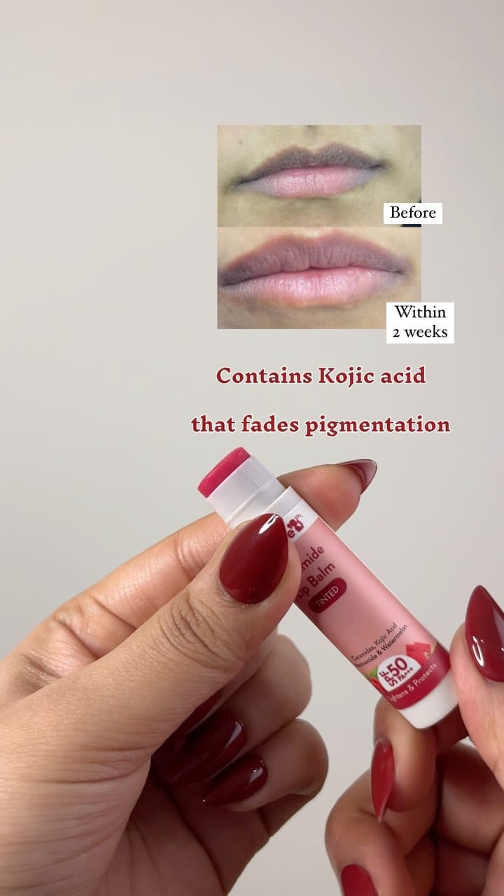 🎀Share this reel with me or comment for link! 
[lip balms, pigmented lips, dark lips, lip lightening, kojic acid, ceramides lip balm, spf, must have, amazon finds]
.
.
.
.
.
.
.
#amazon #amazonfinds #newreel #reelsinstagram #reeloftheday #lipbalm #spflipbalm #pigmentedlips #musthave #lipcare #fypppppppppppppppppppppppppppppppppppppppppppppppppppppppppppppppppppppp
