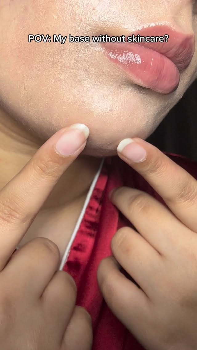 My base without skincare 🤌🏻🫠
@skin1004official #GoViralWithSKIN1004Challenge #SKIN1004White #Blackfriday