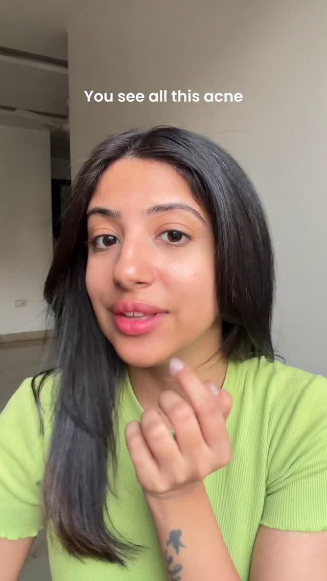 Yes my dermat has been recommending this everytime I visit her, and seriously.. this helps me control my acne like a boss!!
💚 Product mentioned: Bioderma Sébium Gel Moussant
@biodermaindia 
Comment "link" to receive it via DM 🔗
#Collaboration
[anti-acne face wash, Bioderma, Sebum control, acne control, skincare, acne care, oily acne prone skin]
