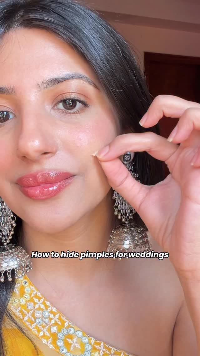 #Collaboration | Acne can't ruin your wedding makeup anymore! 🥲
This Liquid Pimple Patch from @thesolvedskin 
✅ Creates a thin layer to protect active acne from makeup 
✅ Makes bumpy acne look more even under makeup
✅ Has Salicylic Acid & Niacinamide to calm inflammation and reduce redness with regular use
(Be sure to use hydrating makeup, and softly dab it over the patch after drying)
Or use it as a regular pimple patch.. it's so multifunctional!!
💰 DISCOUNT CODE: RUCHIKATSS 
(15% off, cannot be combined with other offers)
Comment "LINK" to receive it via DM 🔗😘
.
.
.
[liquid pimple patch, wedding makeup skincare, anti-acne, acne solution, acne patch]