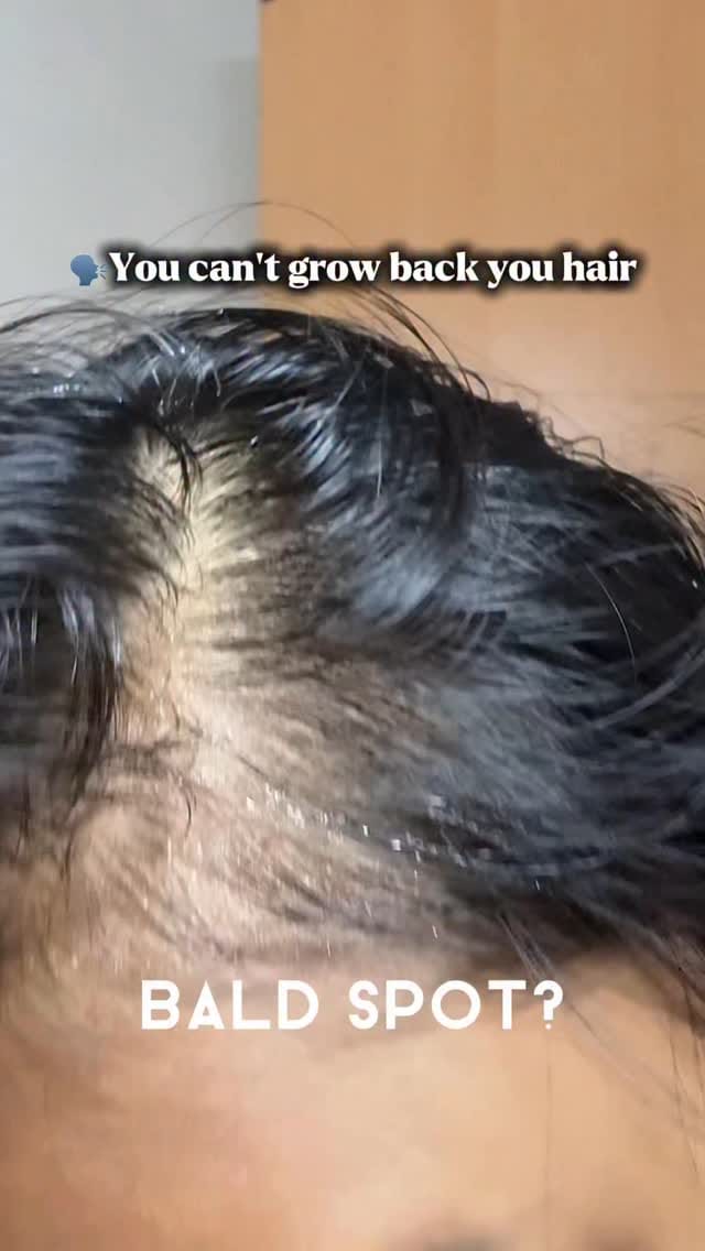 Comment for the link 🔗 
I love this stick, easy to apply and doesn’t make a mess. Just do it anywhere even while out and travelling. I just do it casually while talking with friends and serious I saw a change in just few weeks. 
.
.
.
.
.
.
.
.
.
.
.
.
.
.
.
.
.
.
.
.
.
.
.
.
.
.
.
[Hair Growth Journey, Best hair growth serum, Healthy Hair Goals, Long Hair Secrets, Amazon Bestseller, Hair Care Routine, Hair Transformation, Before And After Hair, Hair Care Tips, Hair Roll On, Hair Serum Review, Rosemary, Aminexil, Anagain, Bodywise, Be Bodywise, Be Bodywise Hair Growth Roll On, Amazon Finds, Nykaa Finds, Tried and Tested, Receding hairline, hair thinning, convenient,  Redensyl, viral hair growth serum, hair growth,  dermatologist]