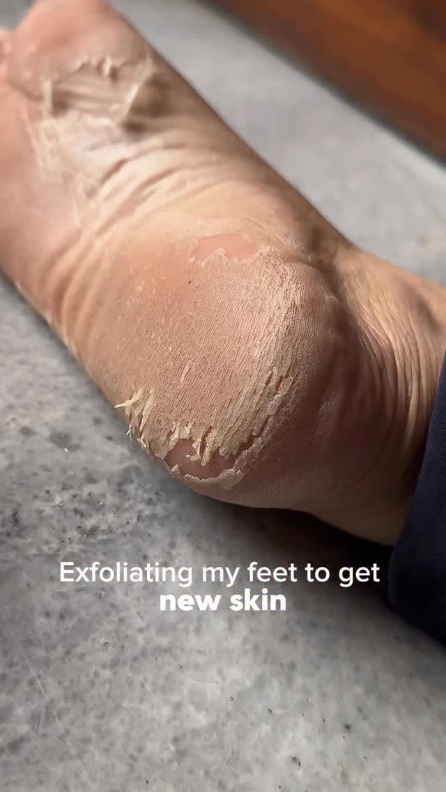 Comment for the link 🔗 
✨ Best Purchase from Amazon! ✨
SeoulSkin Foot Peeling Mask – Say goodbye to rough, dry feet & hello to baby-soft skin! 💖
✅ Deep Exfoliation with Glycolic Acid
✅ Hydrates & Softens
✅ Removes Dead Skin Effortlessly
✅ Cruelty-Free | Vegan | Paraben-Free
📦 Available on 𝐀𝐌𝐀𝐙𝐎𝐍
💬 Comment “LINK” to grab yours now! 🛍️
#FootCare #BabySoftFeet #FootPeel #Exfoliation #SmoothSkin #seoulskinam #SkincareRoutine #SelfCare #BeautyHacks #AmazonFinds #GlowingSkin #PamperYourself #VeganSkincare#shorts #trending  #hacks #instagram #reel #viralhacks #trend