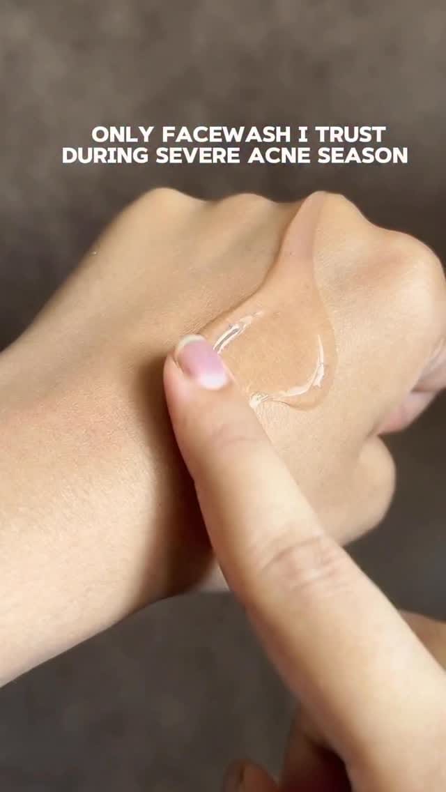 (Not sponsored)To be honest, for Acne in general Facewash is an important step. This is one of the worst season for my FACE. This worked for me, therefore I am suggesting you🧡
Product- salicylic acid facewash for oily skin by @thedermacoindia 
If you are struggling right now, I will tell you basic routine to follow. Basic is enough. For acne-prone combination skin, balance is key: 
Morning:
1️⃣ Gentle cleanse:Use a mild gel-based or foaming facewash to control excess oil without stripping moisture. 
2️⃣ Hydration:Lightweight, non-comedogenic moisturizer to keep your skin happy. 
3️⃣ Protection:Broad-spectrum sunscreen to shield against UV rays. 
Evening:
1️⃣ Double cleanse: Remove makeup and sunscreen with an oil-free micellar water, followed by your ideal facewash. 
2️⃣ Treatment:Apply acne-targeting products like salicylic acid or benzoyl peroxide to treat breakouts. 
3️⃣ Moisturize:Lock in hydration with a calming, non-greasy moisturizer. 
✨ Ideal Facewash Tip: Look for one with salicylic acid❤️to prevent breakouts or ceramides❤️ to maintain your skin barrier. Dermatologically tested and fragrance-free are always winners! 
Here’s what I learned: consistency is key. You need to stick to a simple routine and use products with ingredients that actually work for acne-prone, sensitive skin—think salicylic acid, niacinamide, or tea tree oil. 
To all my acne-prone friends, this is what made the difference. Comment “PRONE”below, and I’ll DM you the details! 💬 #skincareroutine #acnetips #clearerwithconsistency #acne #facewash #Facewashtips #viral #fyp