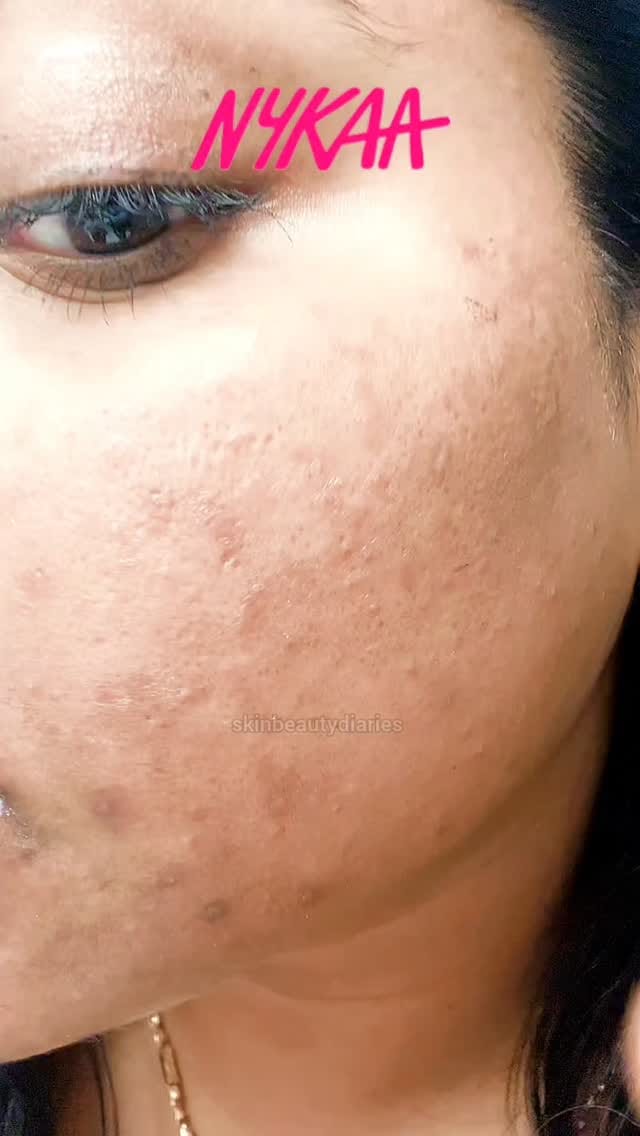 Share this Reel in my DM for Link 🔗
.
.
.
.
#Nykaa #Finds #NykaaFinds #Decor #Home #Beauty #SkinCare #HomeDecor #Lifestyle #Amazing #New #Instagram #Reels #Organize #Storage #Bins #Helpfull #Usefull #ReelsViral #Trending #TrendingNow #ViralNow #HomeProducts #Kitchen #5MinutesCraft #Wishlink #AmazonFind