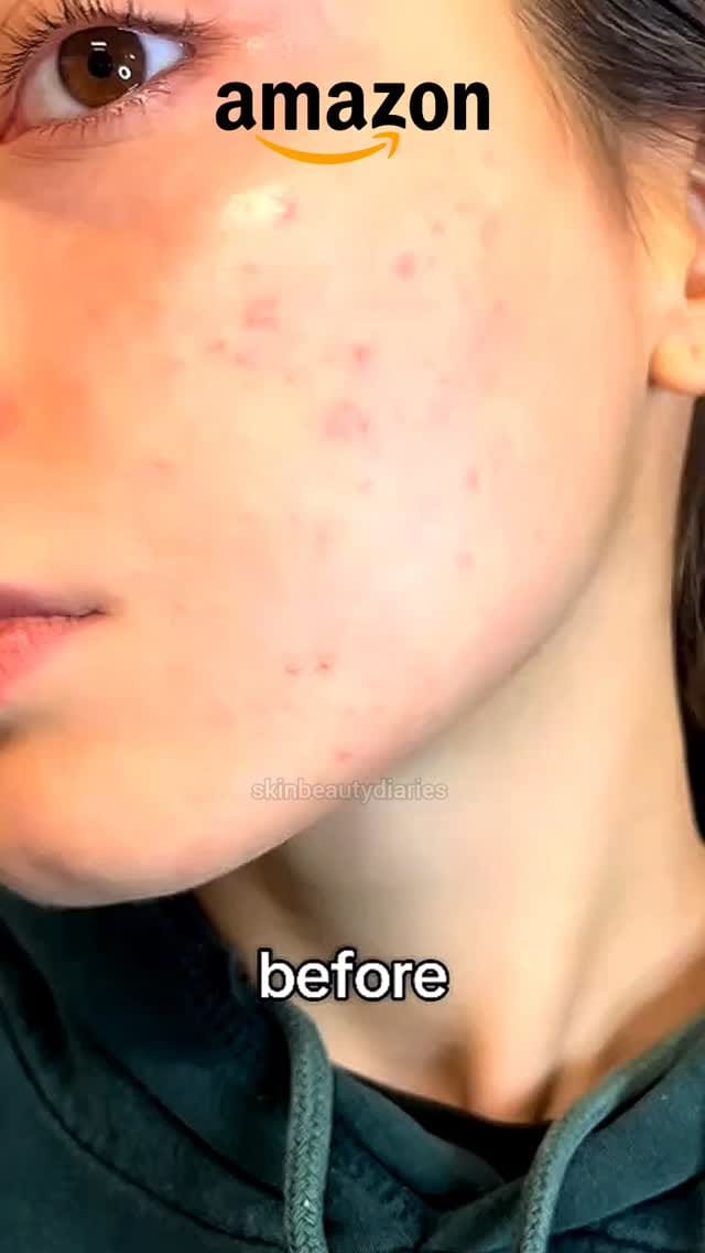 Share this Reel in my DM for Link 🔗
.
.
.
.
#Amazon #Finds #AmazonFinds #Decor #Home Beauty SkinCare HomeDecor Lifestyle Amazing New Instagram Reels Organize Storage Bins Helpfull Usefull ReelsViral Trending TrendingNow ViralNow HomeProducts Kitchen 5MinutesCraft Wishlink AmazonFind