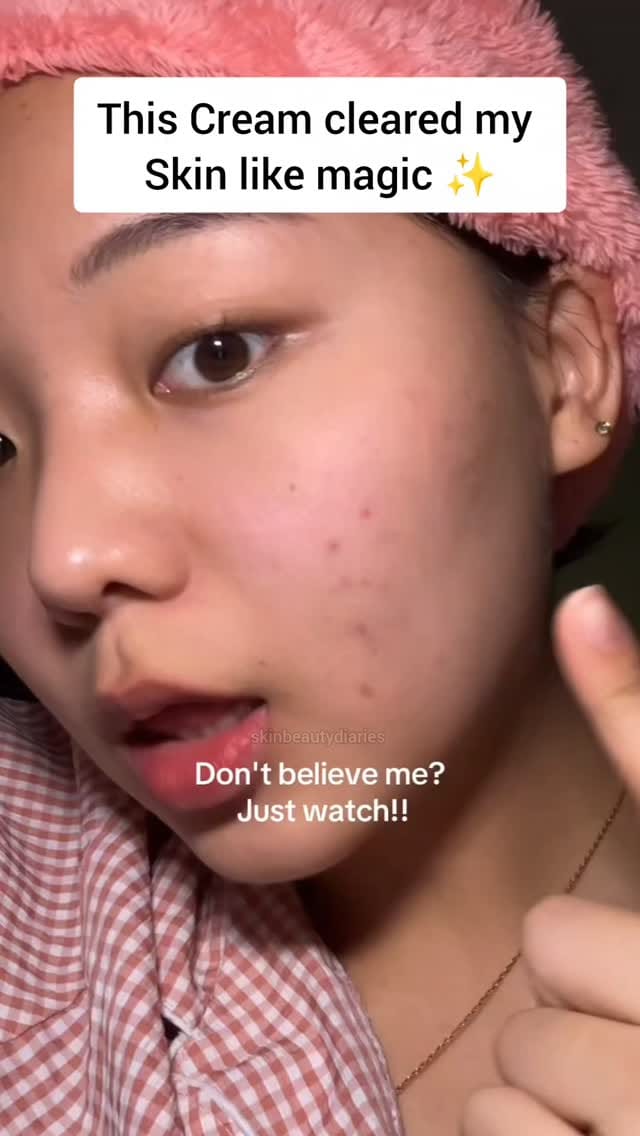 Share this Reel in my DM for Link 🔗
.
.
.
.
#Amazon #Finds #AmazonFinds #Beauty #SkinCare Decor Home  HomeDecor Lifestyle Amazing New Instagram Reels Organize Storage Bins Helpfull Usefull ReelsViral Trending TrendingNow ViralNow HomeProducts Kitchen 5MinutesCraft Wishlink AmazonFind