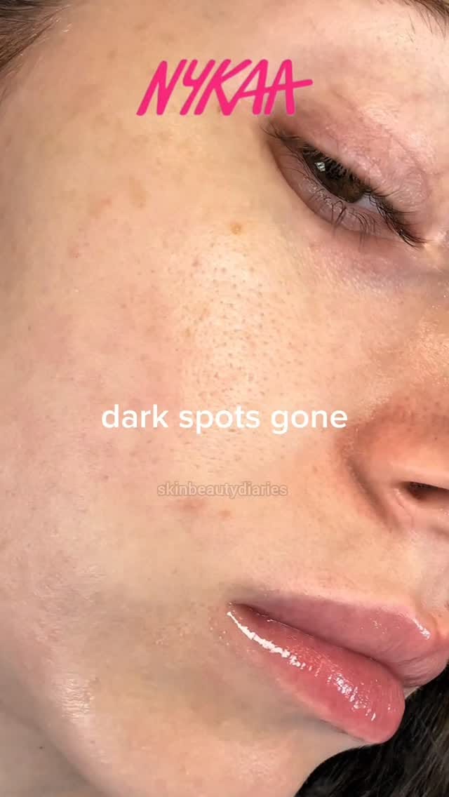 Share this Reel in my DM for Link 🔗
.
.
.
.
#Nykaa #Finds #NykaaFinds #Beauty #SkinCare Home Decor  HomeDecor Lifestyle Amazing New Instagram Reels Organize Storage Bins Helpfull Usefull ReelsViral Trending TrendingNow ViralNow HomeProducts Kitchen 5MinutesCraft Wishlink AmazonFind