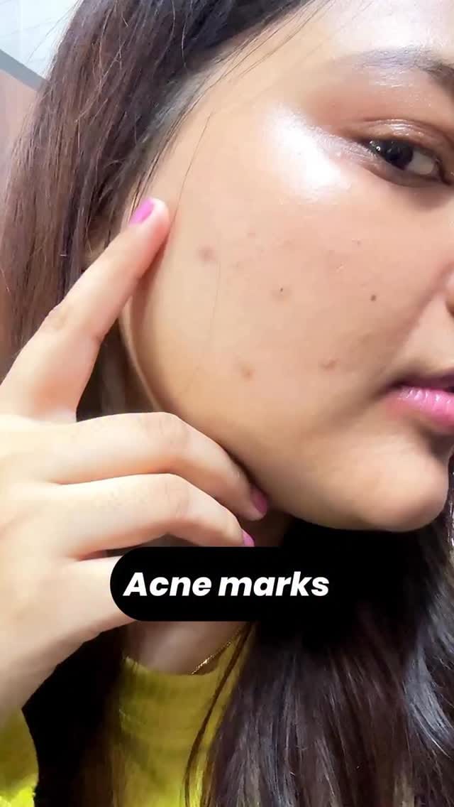 Follow & share this reel in my DM 🔗