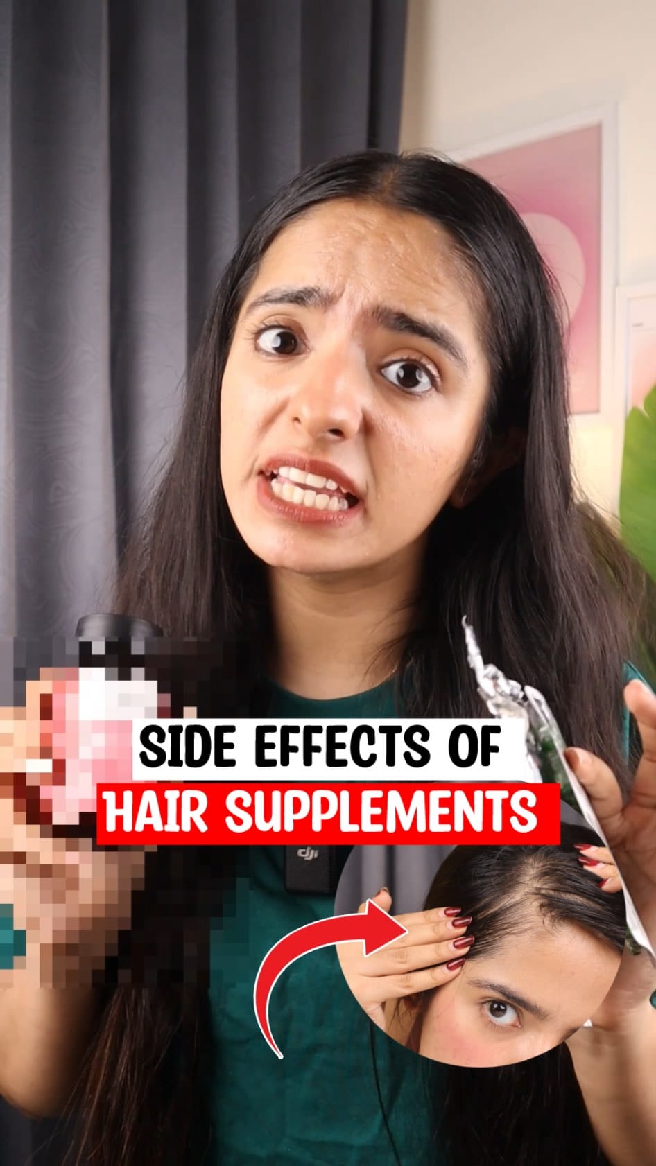 Hair supplements that I consume on daily basis 
.
.
.
.
.
[Hair supplements, supplements, hair growth, hair fall, hair loss, baby hair, hair growth tablets, vitamin e, vitamin C, multivitamin]