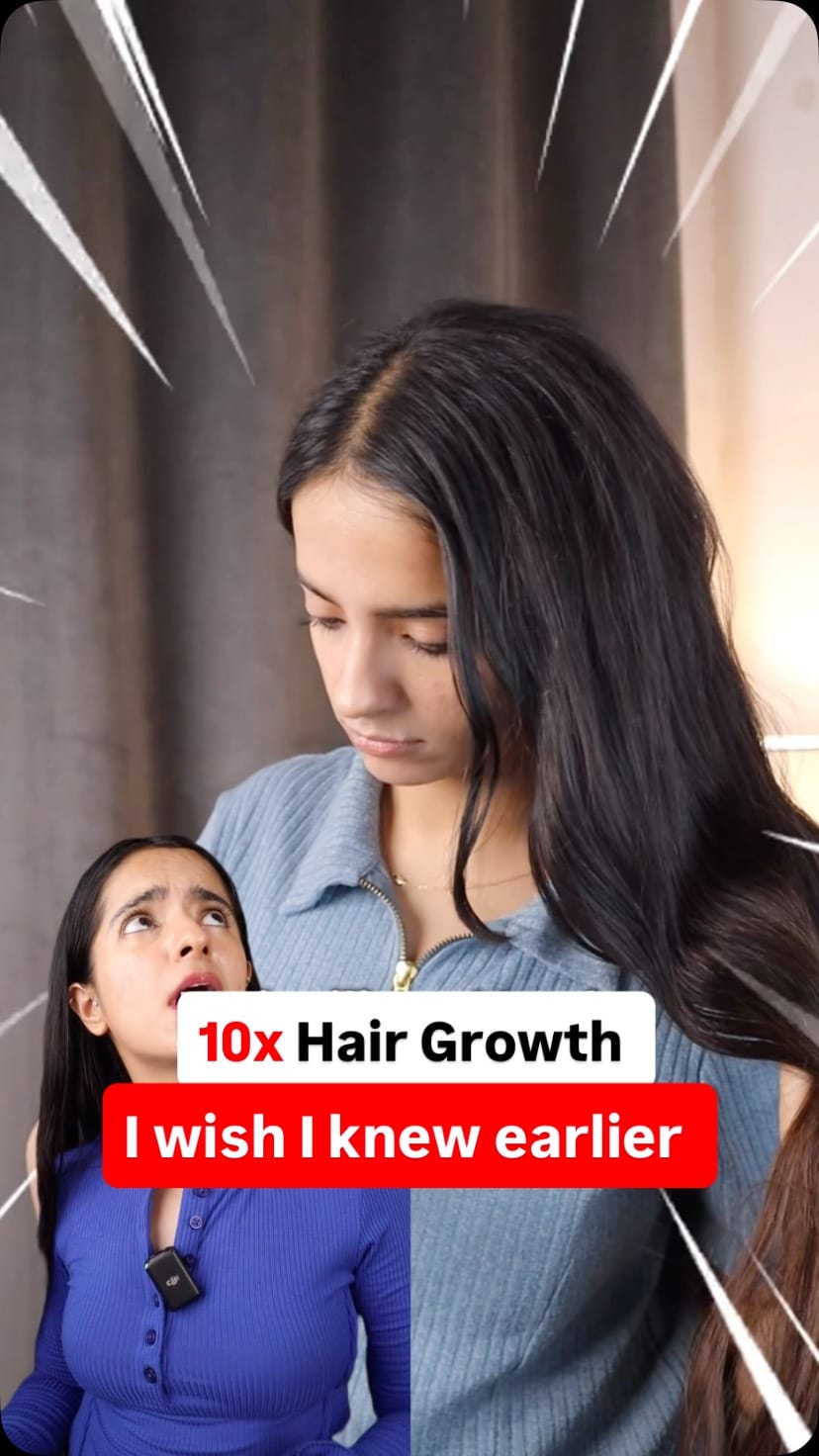 This is what happened when I started using Hair growth serum 
.
.
.
.
[Hair growth serum, hair fall control, hair regrowth oil, fast hair growth, hair growth journey, hair thinning solution, hair growth tips, natural hair growth, regrow hair, hair growth hacks, hair growth before after, hair fall remedy, hair regrowth naturally, long hair secrets, hair care for growth]