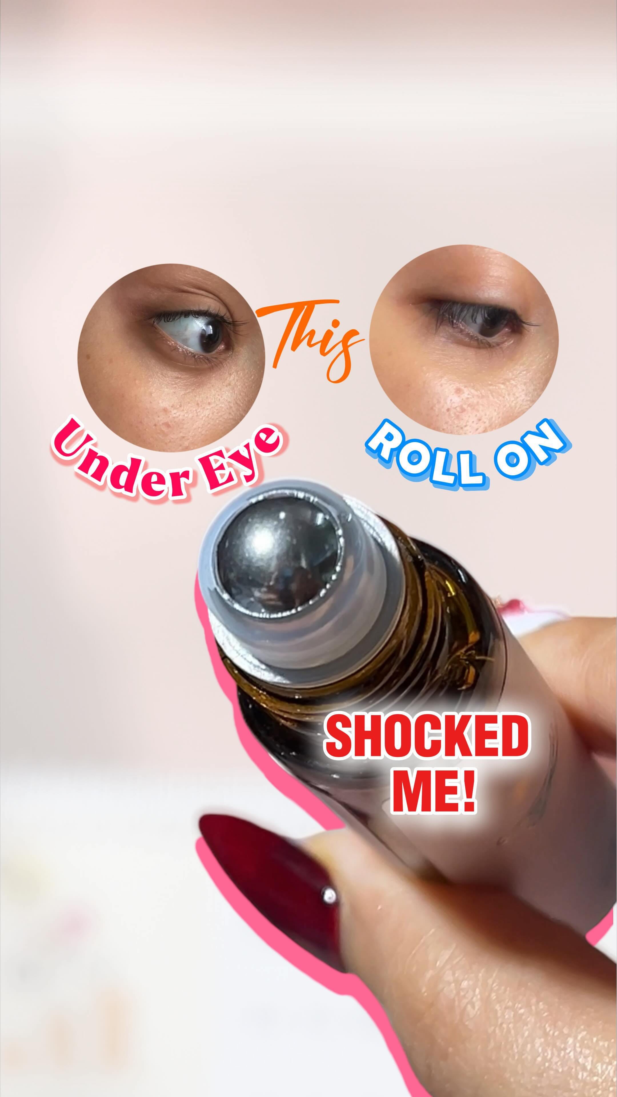 Comment “eye” for the links
I have never used undereye serums before, or maybe for 1-2 months before but this one really surprised me with the results! 
This is a pretty viral product and after seeing so many people talk about it, I wanted to try it out! I wasn’t expecting anything major, but the results made me go crazy! I am going on about this and recommending it to everyone now 😭🩷
#explorepage #viral #undereyeserum #undereyetreatment 
[ meesho finds, under eye serum, skincare routine, dark circles treatment, reels ideas, under eye oil, aesthetic art ]
Guess how many days it took me to notice a difference?